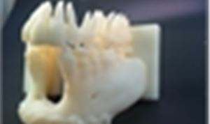 3D Printing Helps Reduce Surgical Time