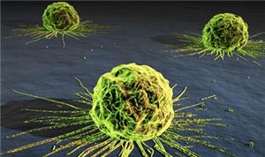 Onychomycosis (nail fungus infection) 